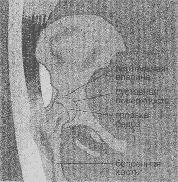 Книгаго: Тотальное эндопротезирование тазобедренного сустава. Иллюстрация № 1